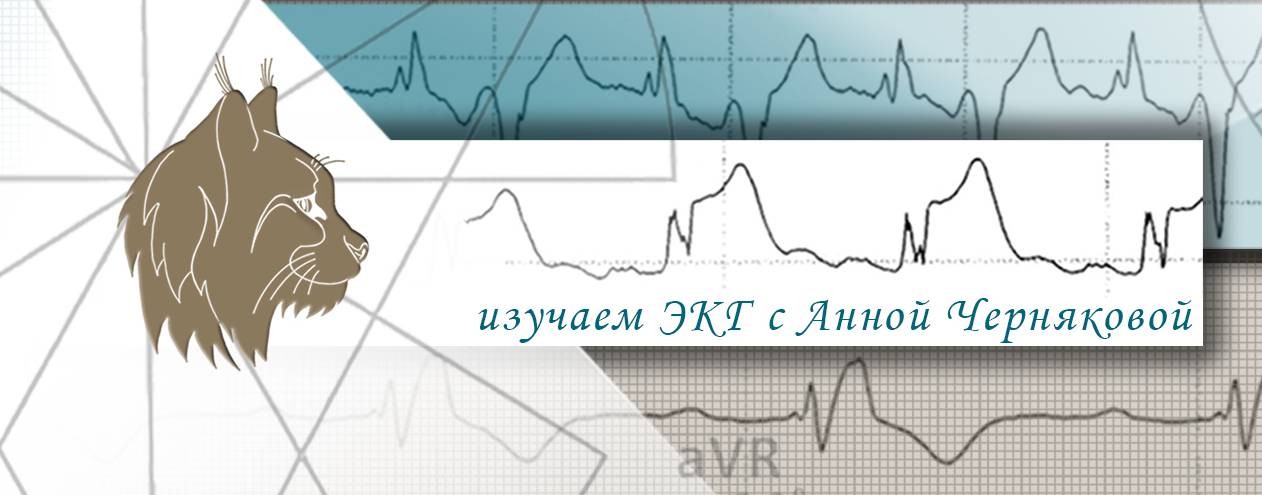 ЭКГ и ХМ