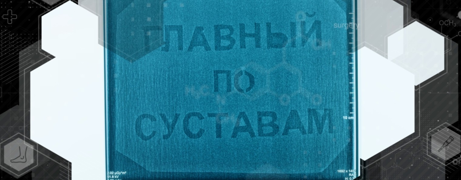 ГЛАВНЫЙ ПО СУСТАВАМ | Баранов Алексей |Травматолог