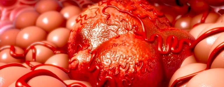 САМЫЙ ПОЗНАВАТЕЛЬНЫЙ КАНАЛ. ВСЁ О РАКЕ ПРОСТАТЫ.