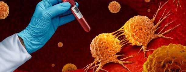 САМЫЙ ПОЗНАВАТЕЛЬНЫЙ КАНАЛ. ВСЁ О РАКЕ ПРОСТАТЫ.