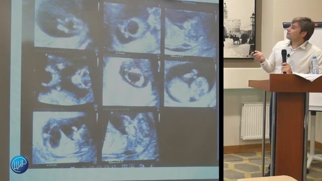 «Современные подходы и тенденции в ультразвуковой диагностике в акушерстве» // Курганников А. С. смотреть онлайн