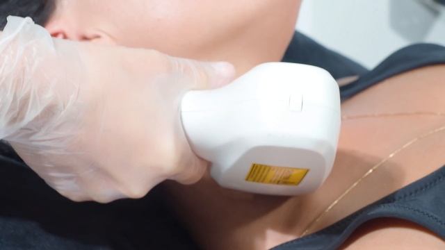 Лазерная эпиляция передней части шеи смотреть онлайн