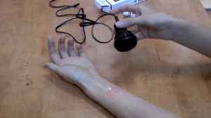 «Ферменкол Гель» + аппарат «Ретон» — набор для фонофореза от шрамов и рубцов