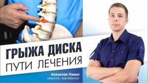 ЛЕЧЕНИЕ межпозвонковой грыжи диска. 3 варианта для всех пациентов.
