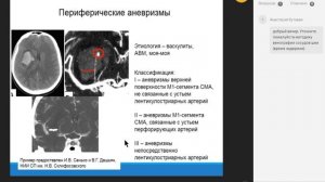 КТ ангиография интракраниальных артерий