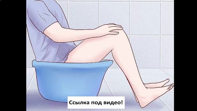 геморрой саранск смотреть онлайн