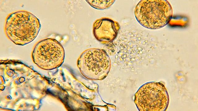 Пыльца березы водная эмульсия под микроскопом (собрана во время цветения березы) смотреть онлайн