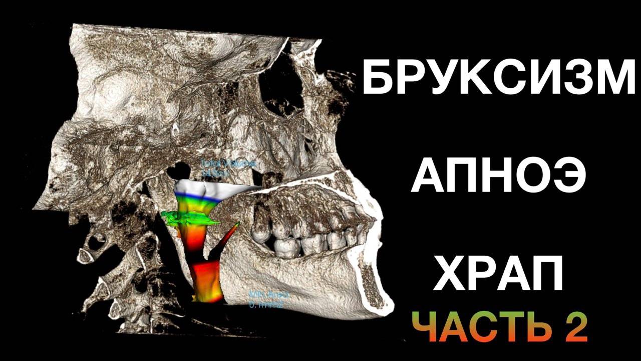 | Борис | Симптомы в процессе сплинт терапии |