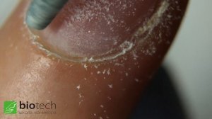 РАСКРЫТИЕ КУТИКУЛЫ ПЕРЕД СРЕЗОМ