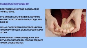 Объяснение нервной (нейропатической) боли