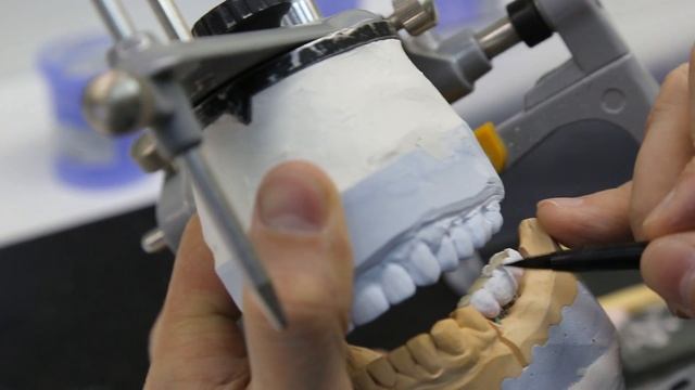 Основатель зуботехнической лаборатории об ортопедическом лечении