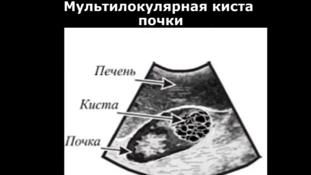 Атлас УЗИ. 15 разделов ультразвукового исследования нормы и патологии