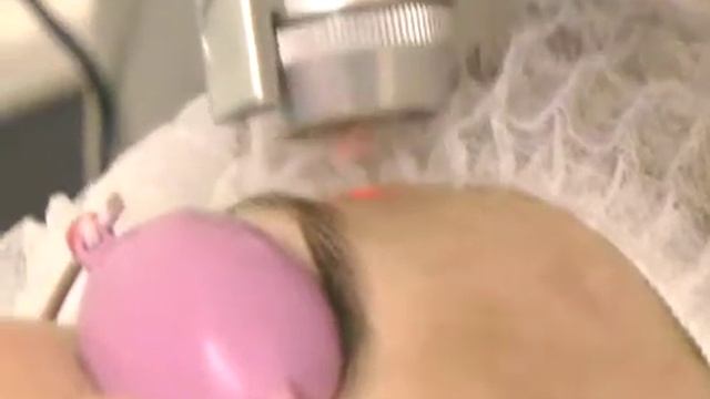 Лазерное омоложение без повреждения кожи - Шарова О.О. смотреть онлайн