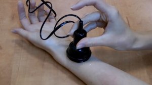 Фонофорез с гелем Ферменкол при помощи аппарата Ретон