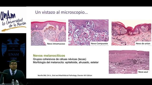 Lesiones Pigmentadas en la Mucosa Oral смотреть онлайн