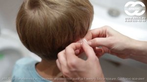 Убрать торчащие уши в домашних условиях