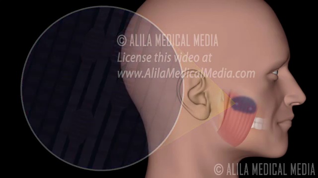 Trouble de l' ATM - Bruxisme [Flokossama] смотреть онлайн