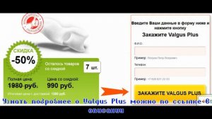 Как лечить вальгусную деформацию стопы