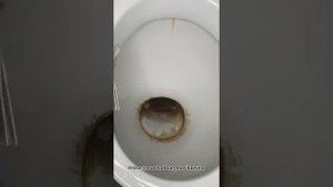 Унитаздың қағын тазалаймыз. Как очистить унитаз от накипи