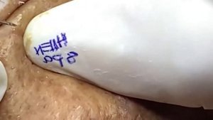 Relax squeezing out blackheads #30 Черные точки