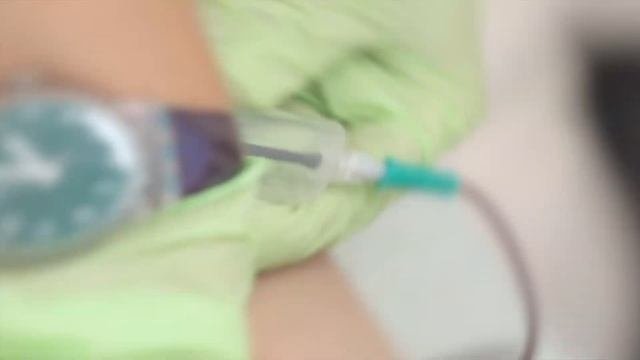 Плазмолифтинг в косметологии и трихологии