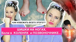 Шишки на ногах, боль в коленях и пояснице - как избежать всего этого??!Канал АлизеБлина