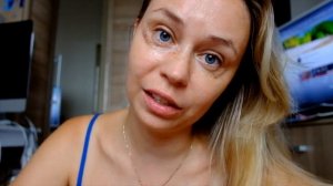 фотоомоложение под глазами. До и после. Отзыв сразу после по дням восстановление.