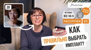 Как правильно выбрать импланты?⭐️+7 (495) 255-59-37 Алла, 61 год. Видеоотзыв.