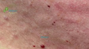 Make Your Day Relaxing with Windy Spa 6#44