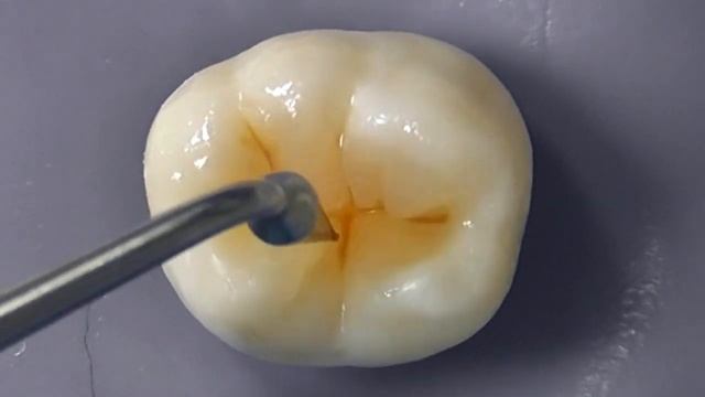 СЕКЦИОННАЯ МЕТОДИКА МОДЕЛИРОВАНИЯ ОККЛЮЗИОННОЙ ПОВЕРХНОСТИ