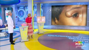 Удалить нельзя оставить. Липома. Жить здорово! Фрагмент выпуска от 19.06.2019