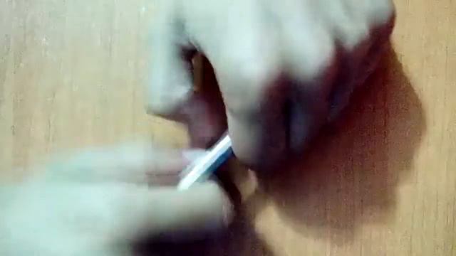 ОТКРЫТЫЙ ПЕРЕЛОМ!ЖЕСТЬ!18+СЛАБОНЕРВНЫМ НЕ СМОТРЕТЬ!