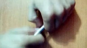 ОТКРЫТЫЙ ПЕРЕЛОМ!ЖЕСТЬ!18+СЛАБОНЕРВНЫМ НЕ СМОТРЕТЬ!