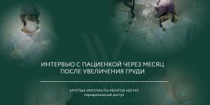 Увеличение груди имплантами круглой формы Mentor 450 мл