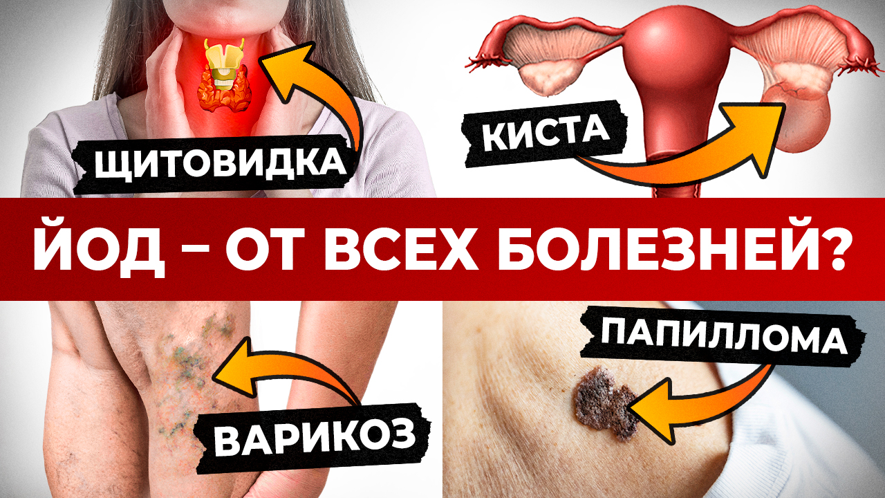 Что творит ЙОД? / Вот поэтому ЯПОНЦЫ не болеют и живут долго!