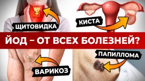 Что творит ЙОД? / Вот поэтому ЯПОНЦЫ не болеют и живут долго!