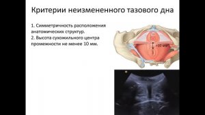 УЗИ тазового дна. Опущение и выпадение тазовых органов.
