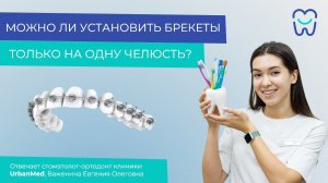 Можно ли установить брекеты только на одну челюсть?