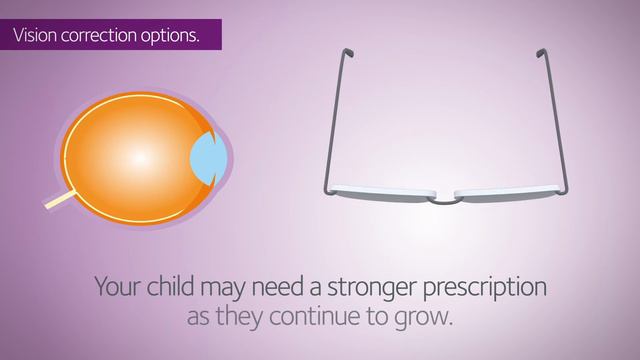 What are the signs of Myopia? смотреть онлайн