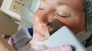 Чистка лица в Эстетик СПА (этапы процедуры)