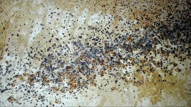 Постельные клопы и как они кусают
