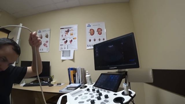 ЕДЕМ С РОЕМ НА УЗИ ВНУТРЕННИХ ОРГАНОВ!! ЧТО ТО ВРАЧУ НЕ ПОНРАВИЛОСЬ.... смотреть онлайн