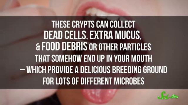 SciShow: Тонзилитные пробки смотреть онлайн