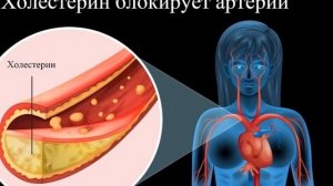 Три рецепта для очищения и укрепления сосудов