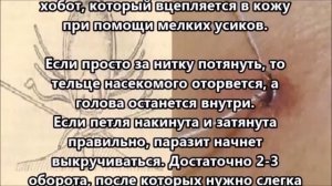 Клещь. Как правильно вытащить клеща.