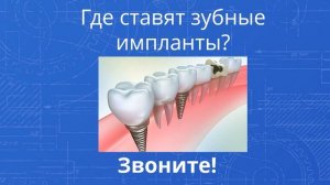 зубные импланты для пожилых оренбург - Звоните! 560-560