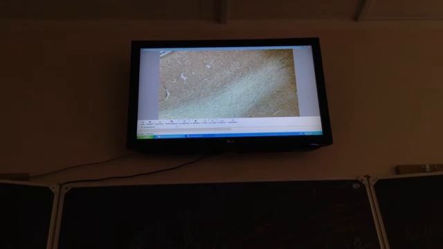 Гистология. Кора больших полушарий смотреть онлайн