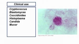 USMLE RX - 7.Микробиология - 1.Антимикробные средства - 40.Амфотерицин В