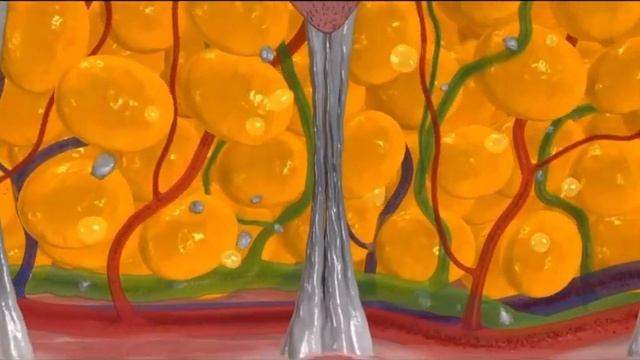 Emtone: эффективное и неинвазивное лечение целлюлита смотреть онлайн