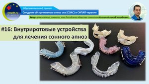 #16: Внутриротовые приспособления для лечения сонного апноэ | СОАС и СИПАП-терапия